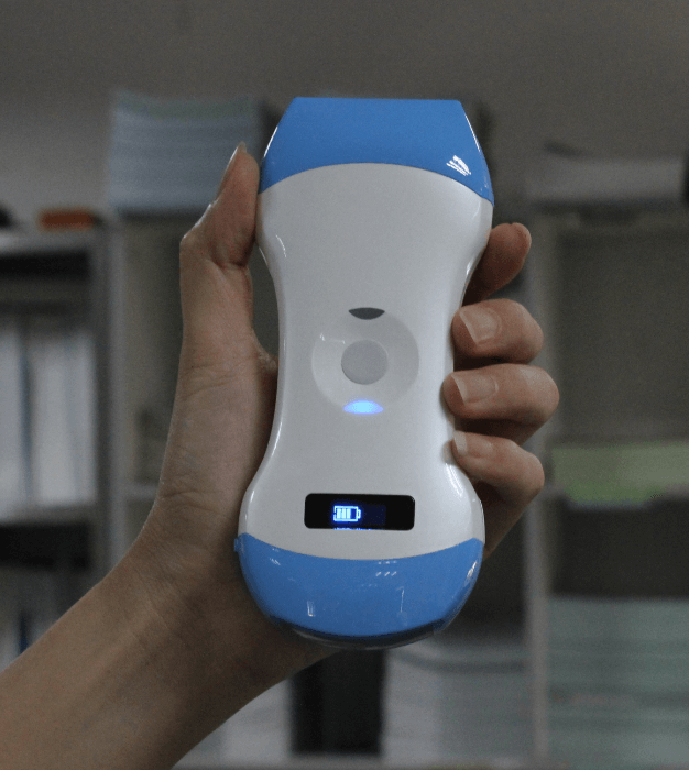 Easy to have a mini ultrasound scanner, the spring for doctors