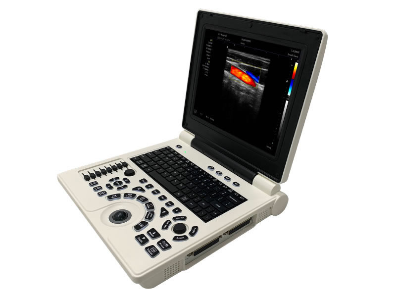 C2 Laptop Color Doppler Ultrasound Scanner