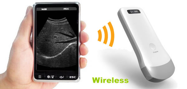 May 11, 2015 Our Wireless Ultrasound Probe Scanner Launch to Market