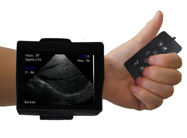 October 16, 2012 We launch ultrasound scanner only 140g