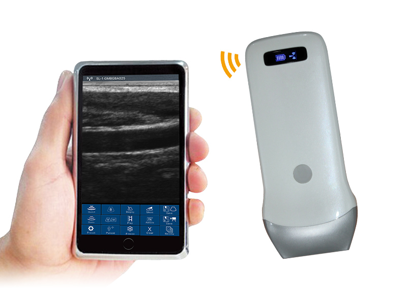 3L linear palm B/W ultrasound