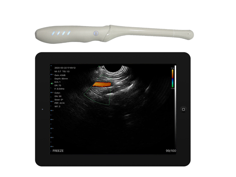 4T transvaginal palm doppler ultrasound