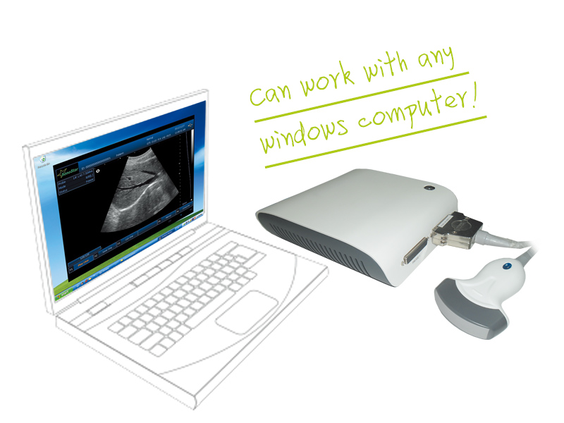 UBox-10 Ultrasound B Scanner Box(with 3D imagingultrasoniblack whitescanner)
