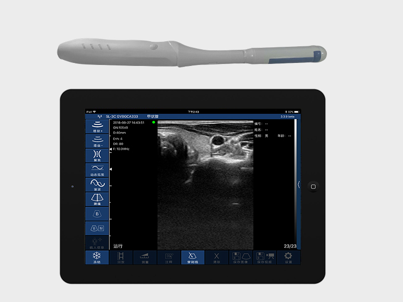 4RC biplane rectal palm doppler ultrasound
