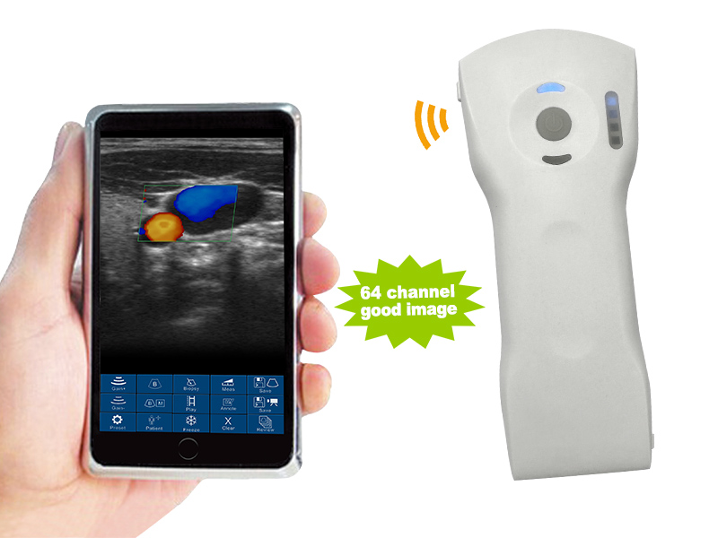 8CL 2in1 palm doppler ultrasound