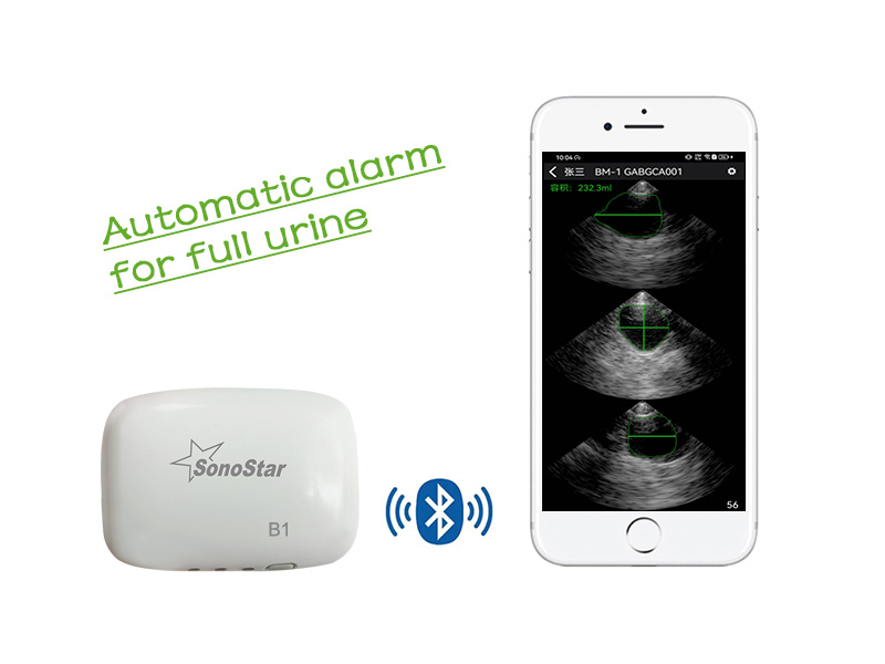 B1 Urine Volume Monitor APP(Android)