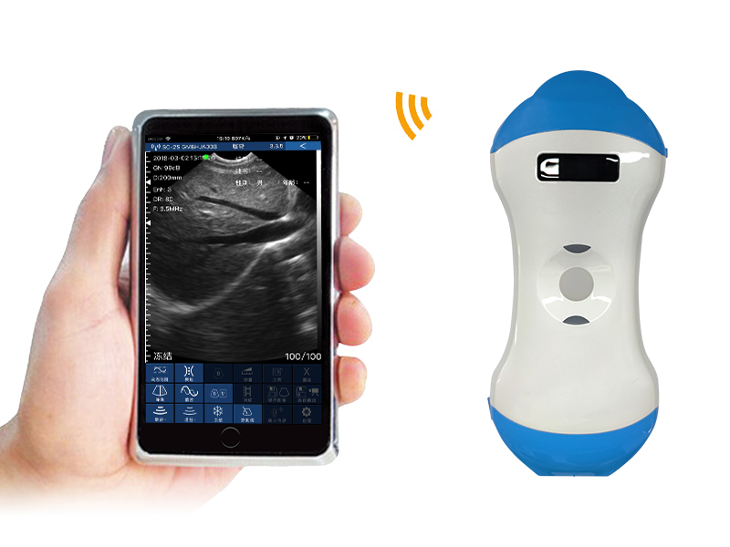 5MN 2in1 palm doppler ultrasound