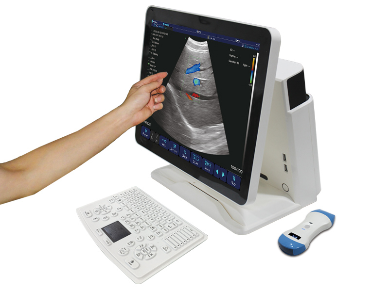CTouch-10 Touch screen & portable wireless color doppler ultrasound machine