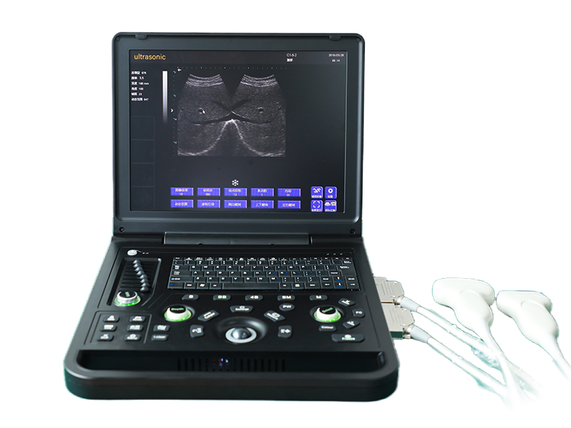 SS-7C Laptop All-Digital Ultrasound Diagnostic System