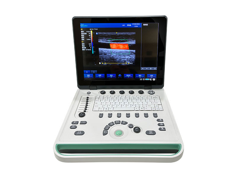 C5N Laptop Color Doppler