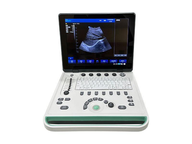 SS-8C Laptop Ultrasound Scanner