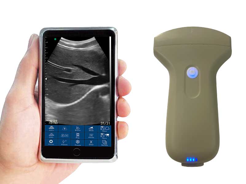 3C convex palm doppler ultrasound