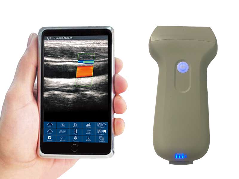 3L linear palm doppler ultrasound