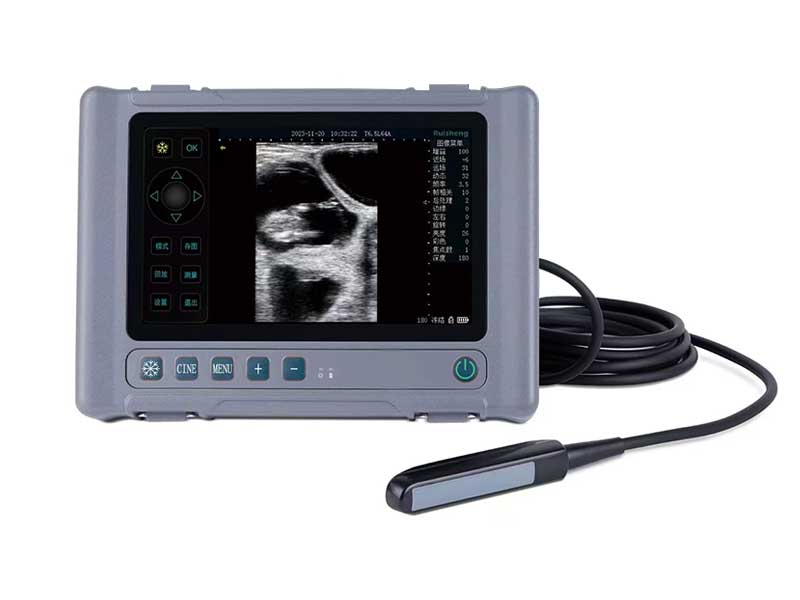 V6 Full Digital Ultrasound Diagnostic System