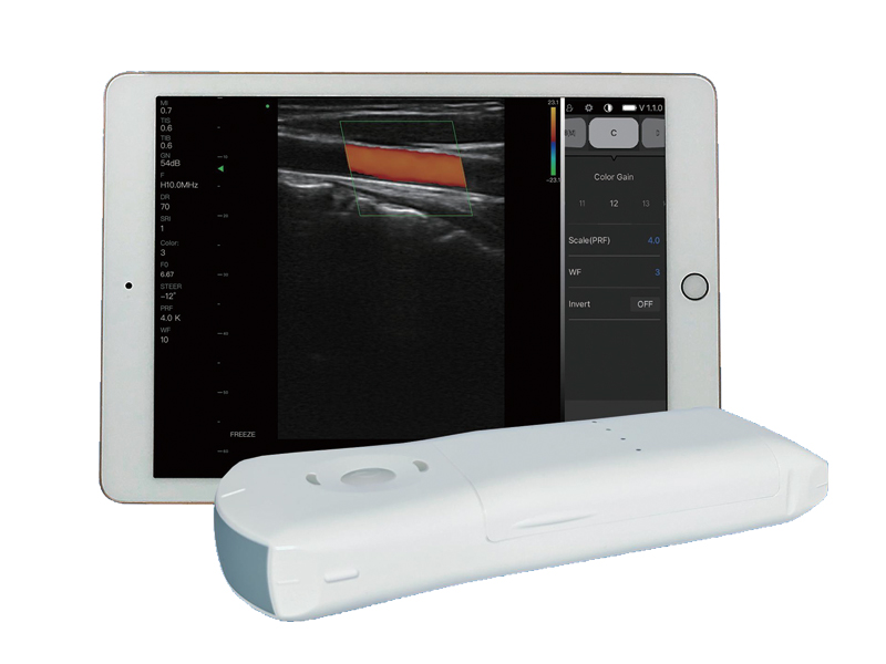 10CPL 3in1 palm doppler ultrasound