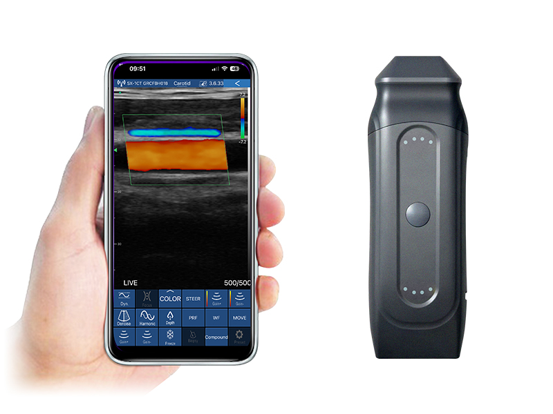 4HL 2in1 palm doppler ultrasound