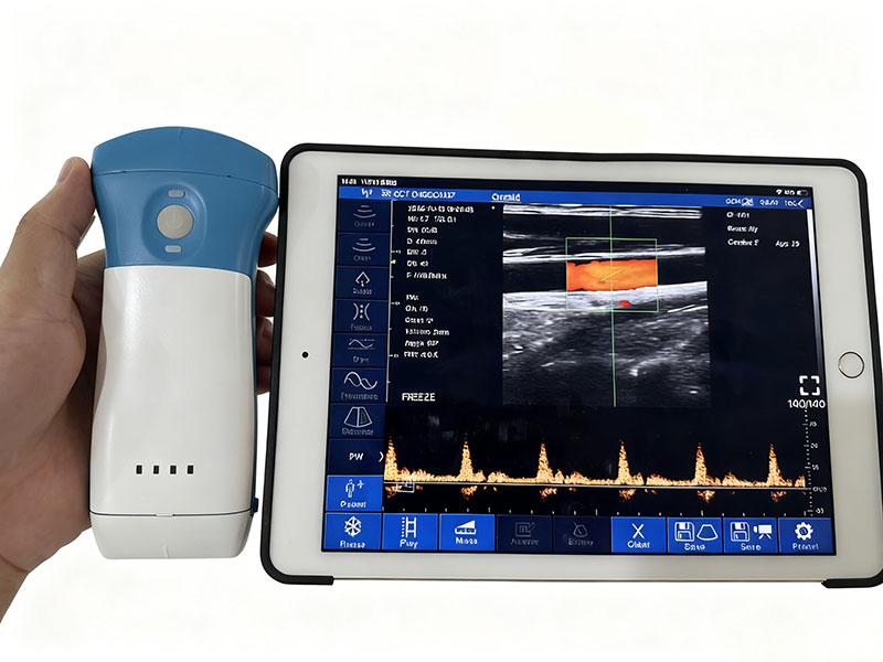 K8CPL 3in1 palm doppler ultrasound