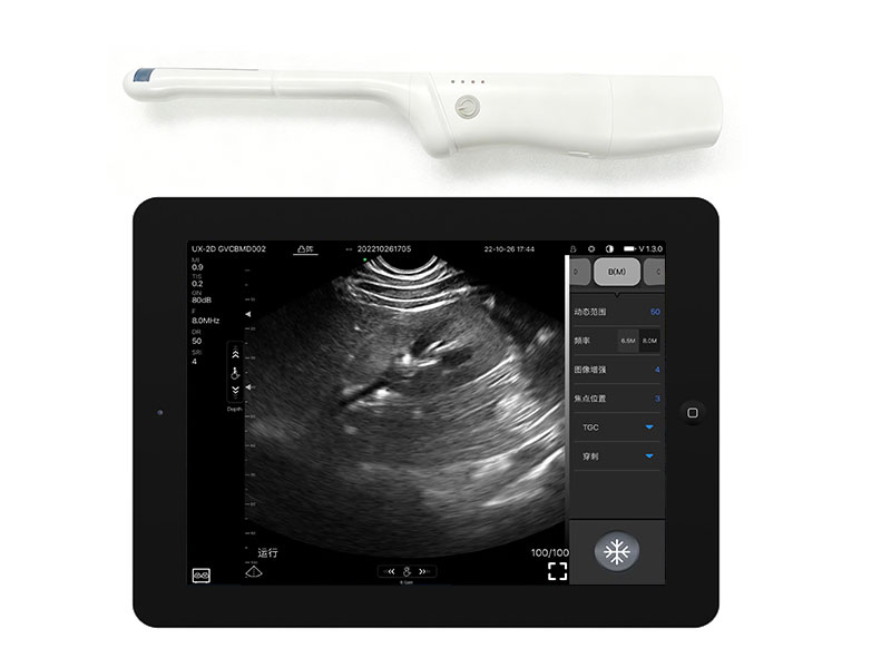 8CR biplane rectal palm doppler ultrasound