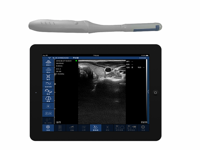 4CR biplane rectal palm doppler ultrasound