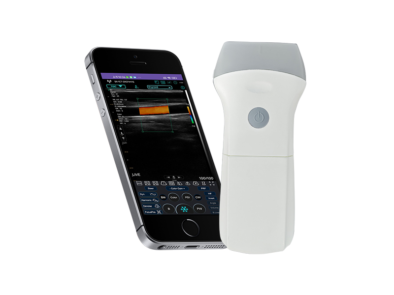 9L Replaceable Battery linear palm doppler ultrasound