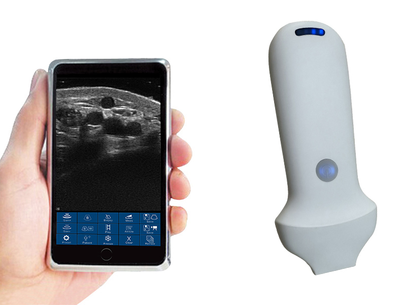 8H linear palm doppler ultrasound