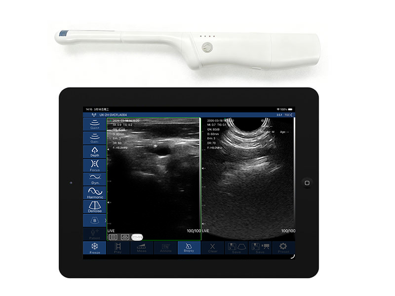 8CR biplane rectal palm doppler ultrasound scanner(VIP Exclusive)