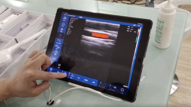 Pocket Handheld Ultrasound Pocket Handheld Ultrasound